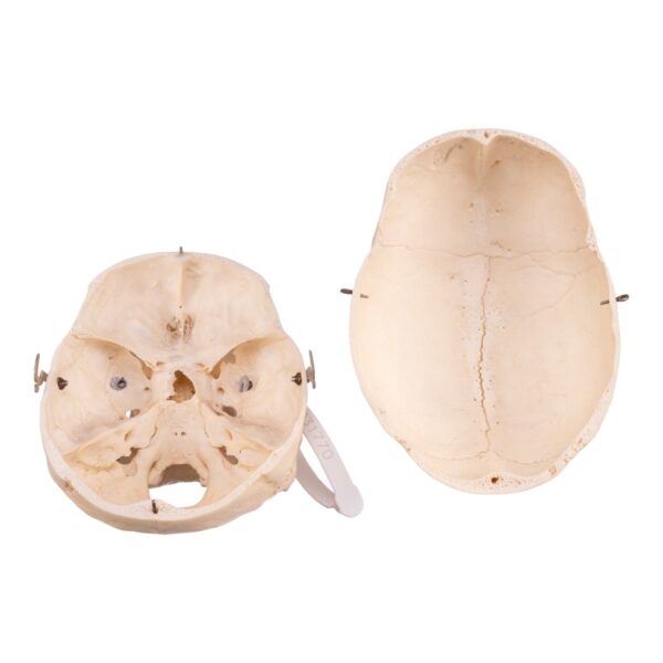 Skeleton - Disarticulated

30377 - Image 6