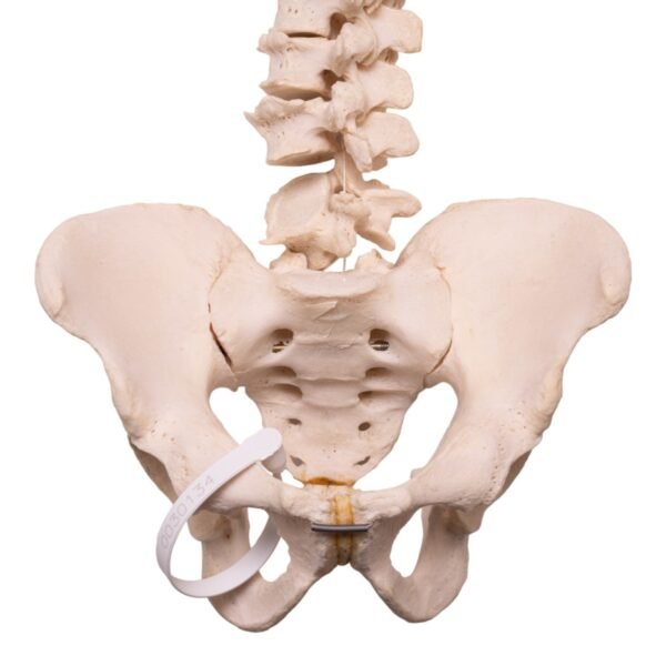 Spine 30132 - Image 2