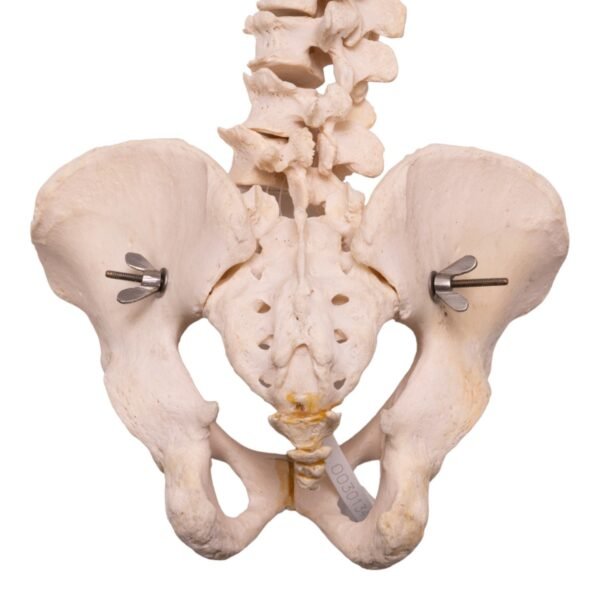 Spine 30132 - Image 3