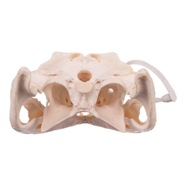 Nile Crocodile Skull - Pathology

31908 - Image 4
