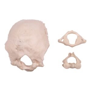 Occipital Bone, Atlas, and Axis

20124
