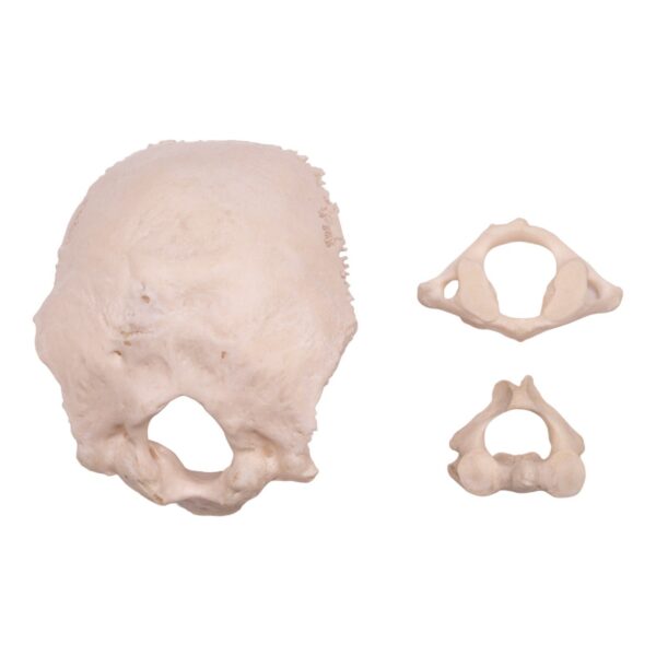 Occipital Bone, Atlas, and Axis

20124