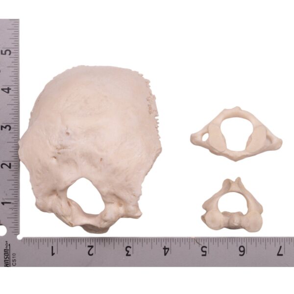 Occipital Bone, Atlas, and Axis

20124 - Image 2