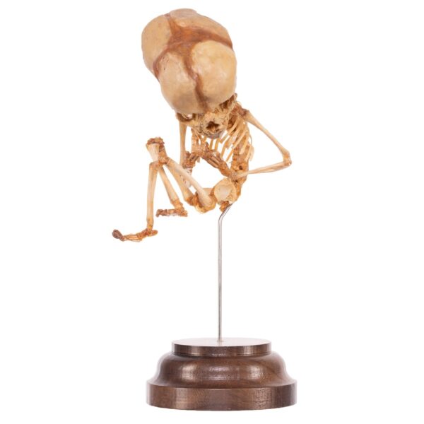 Fetal Skeleton On Stand

52320