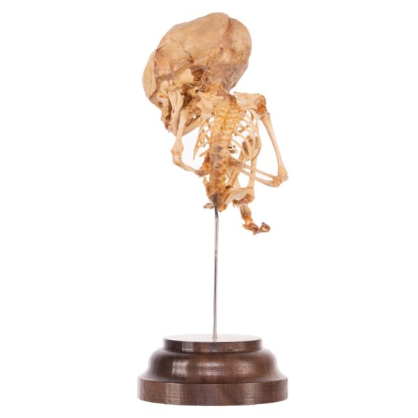 Fetal Skeleton On Stand

52320 - Image 3
