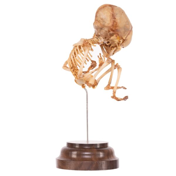 Fetal Skeleton On Stand

52320 - Image 2