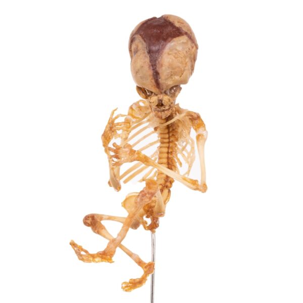 Fetal Skeleton On Stand

6319 - Image 3