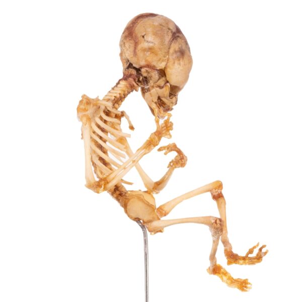 Fetal Skeleton On Stand

6319 - Image 2