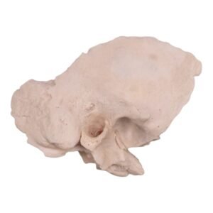 Right Temporal Bone