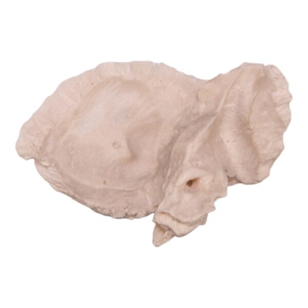 Right Temporal Bone - Image 2