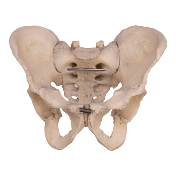 Pelvis, Sacrum, and Coccyx - Articulated