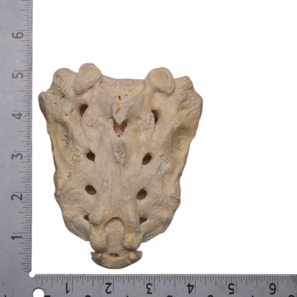 Real Human Sacrum - Image 3