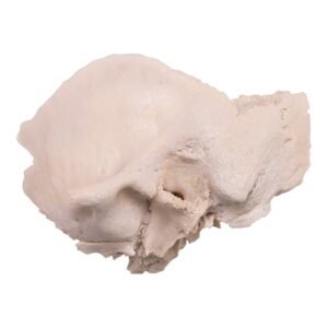 Left Temporal Bone