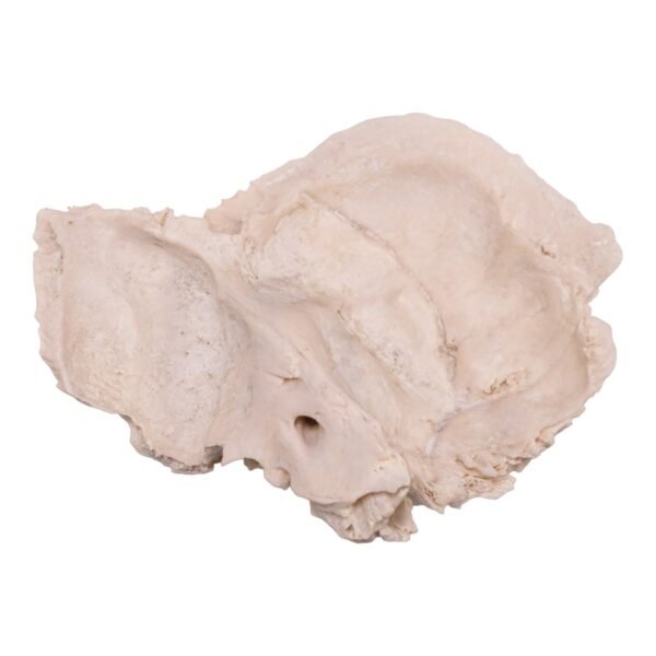 Left Temporal Bone - Image 2
