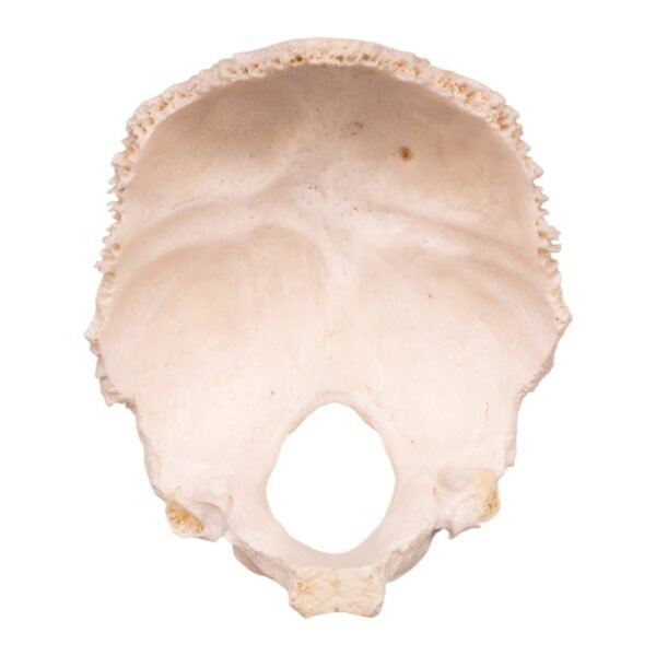 Occipital Bone
30154 - Image 2