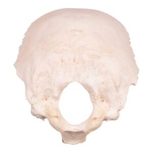 Occipital Bone
30154