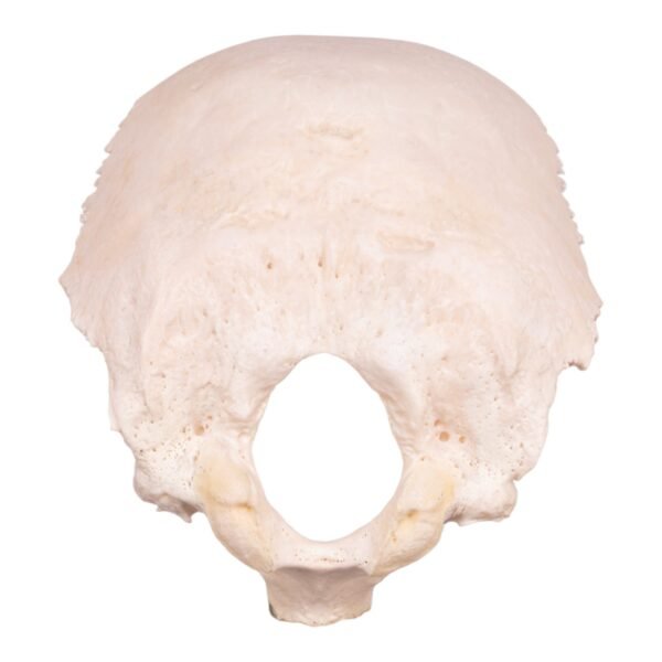 Occipital Bone
30154