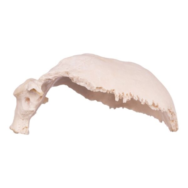 Occipital Bone
30154 - Image 4