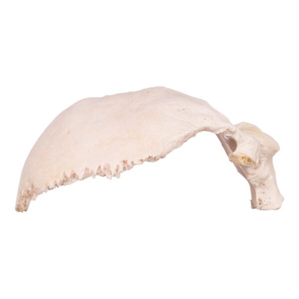 Occipital Bone
30154 - Image 3