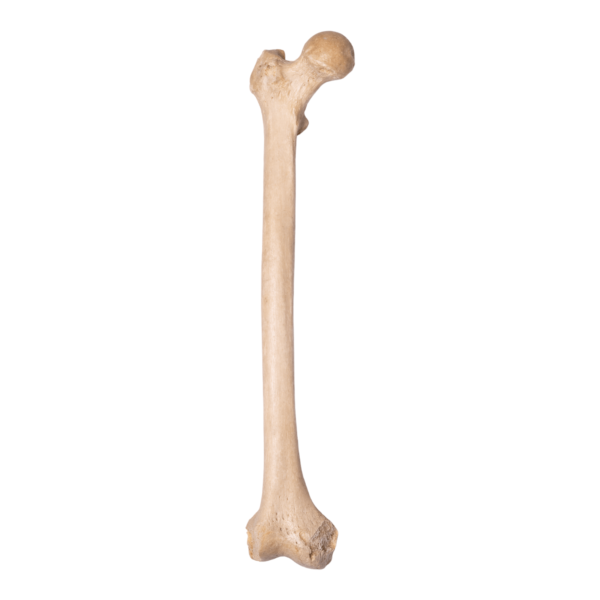 Femur - Antique

12593-A - Image 6