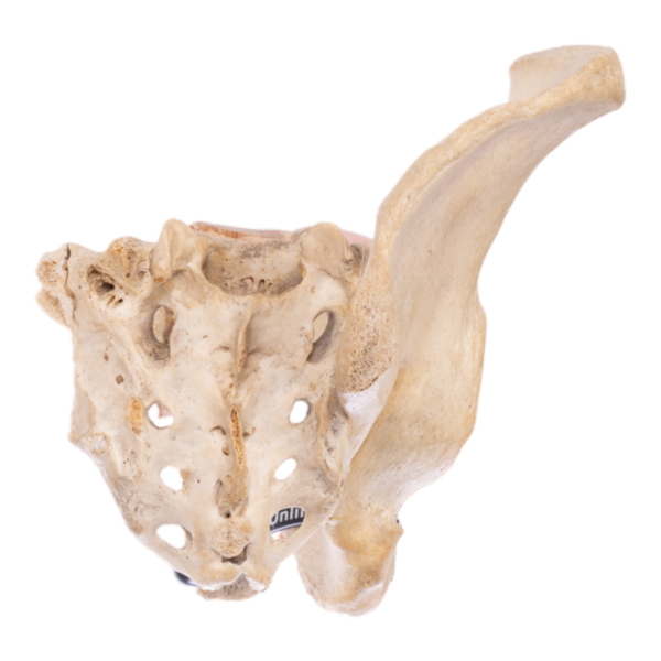 Pelvis - Partial, Antique

26872 - Image 2