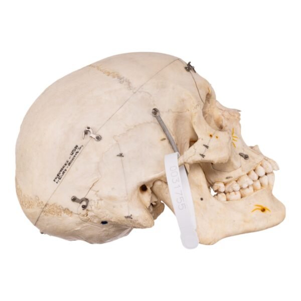 Dissected Skull with Carrying Case - Image 2