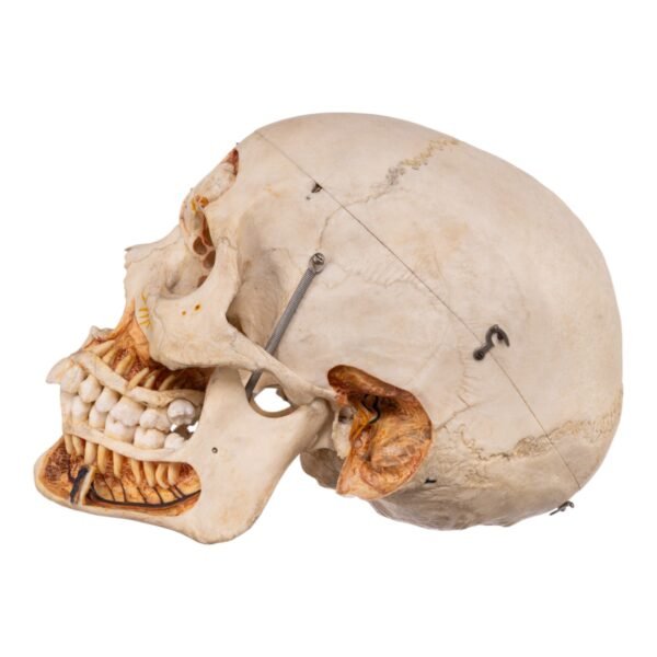 Dissected Skull with Carrying Case - Image 3