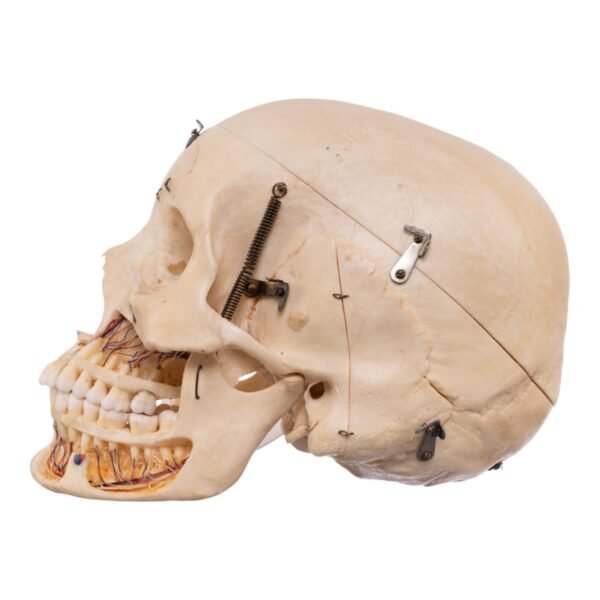 Dissected Skull with Carrying Case - Image 2