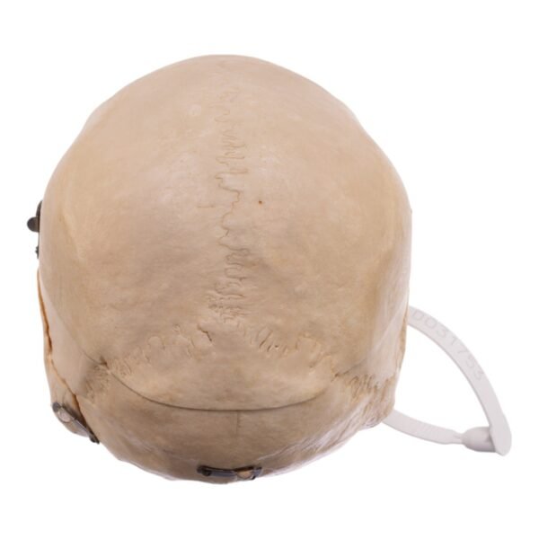 Dissected Skull with Carrying Case - Image 4