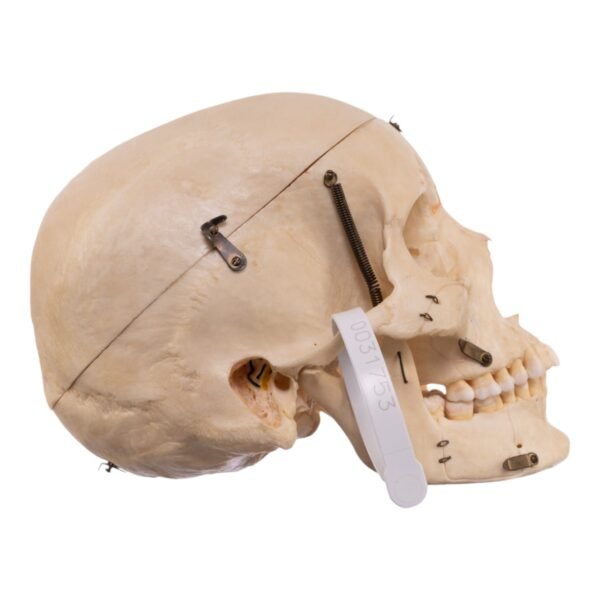 Dissected Skull with Carrying Case - Image 3