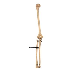 Left Arm - Articulated, Partial