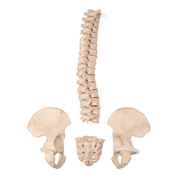 Spine, Sacrum, and Pelvis - Disarticulated