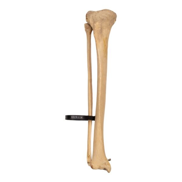 Tibia and Fibula - Articulated