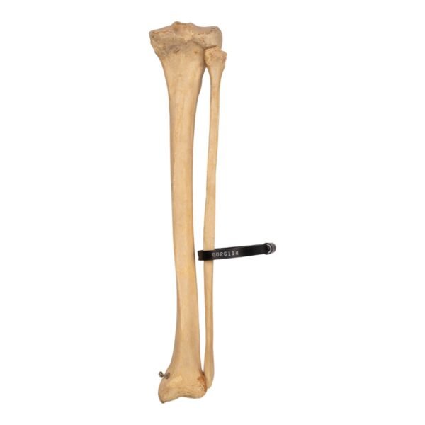 Tibia and Fibula - Articulated - Image 2
