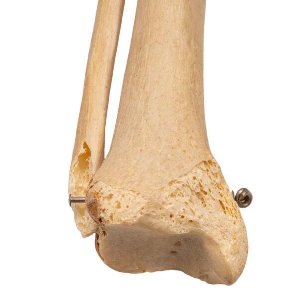Tibia and Fibula - Articulated - Image 3