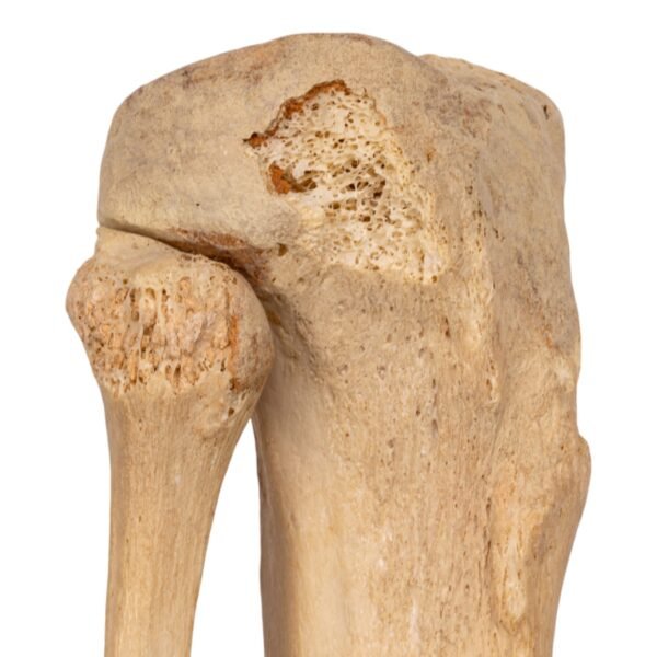 Tibia and Fibula - Articulated - Image 4