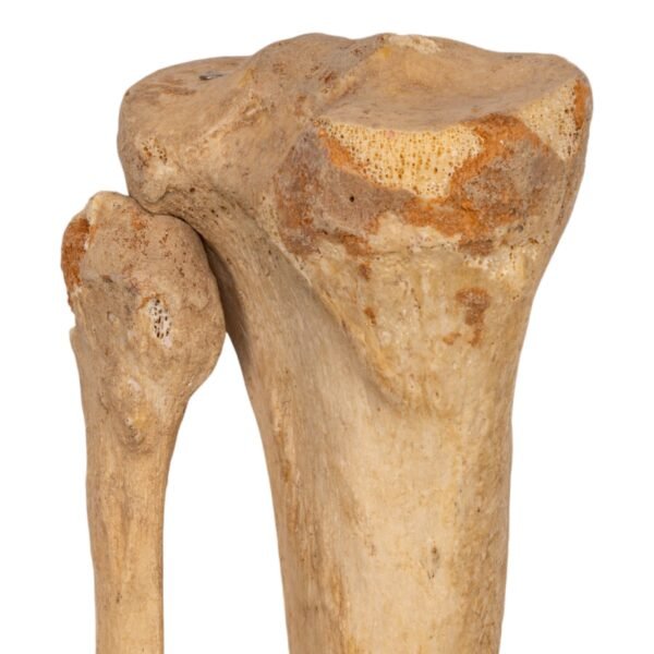 Tibia and Fibula - Articulated - Image 3