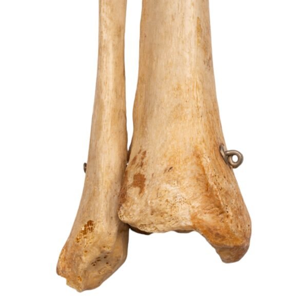 Tibia and Fibula - Articulated - Image 4