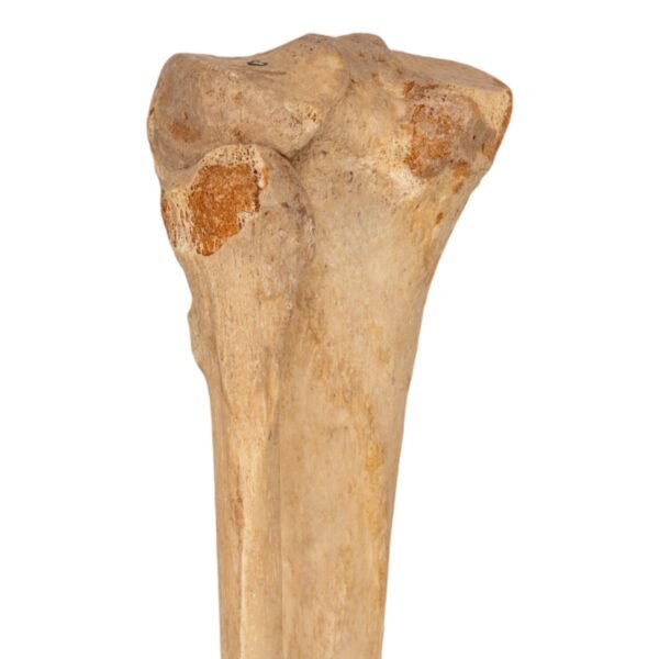 Tibia and Fibula - Articulated - Image 2