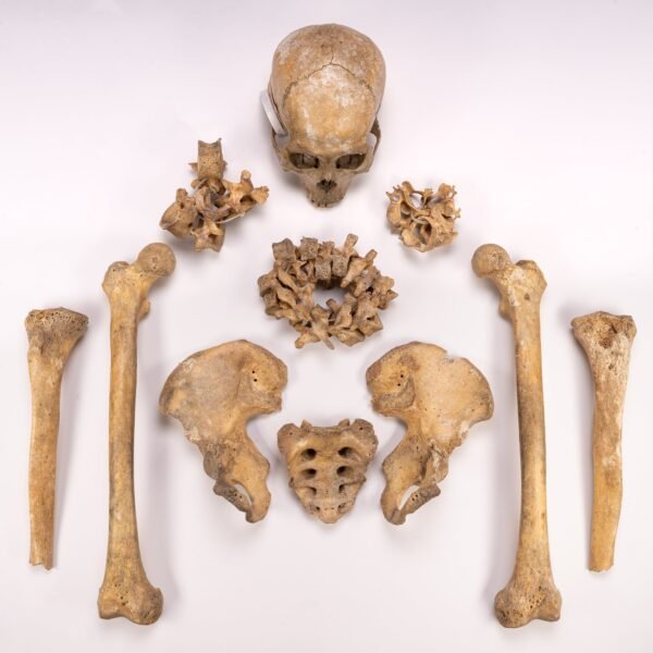 Partial Skeleton - Disarticulated