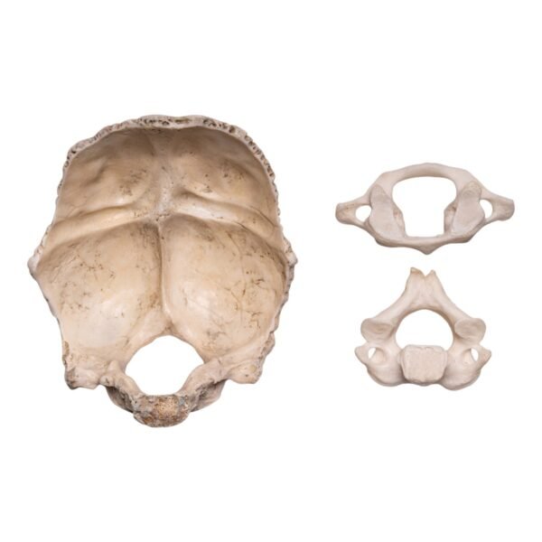 Occipital Bone, Axis, and Atlas
30227 - Image 2