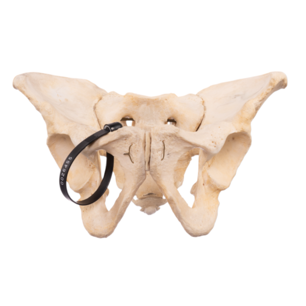 Pelvis, Sacrum, and Coccyx - Articulated