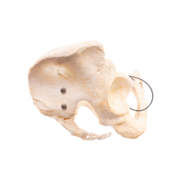 Pelvis, Sacrum, and Coccyx - Articulated - Image 4