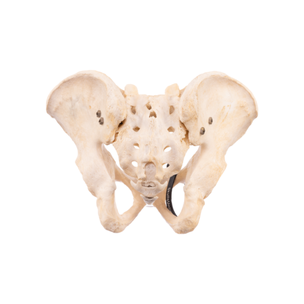 Pelvis, Sacrum, and Coccyx - Articulated - Image 2