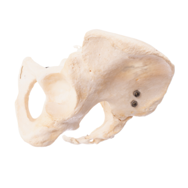 Pelvis, Sacrum, and Coccyx - Articulated - Image 3