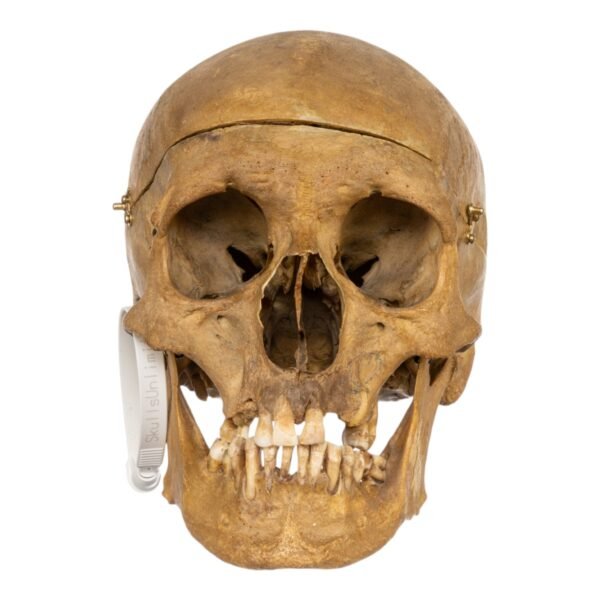 Medical skull (1683)