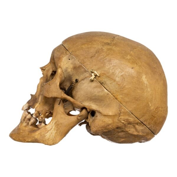 Medical skull (1683) - Image 3