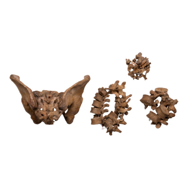Spine, Pelvis, and Sacrum - Image 2