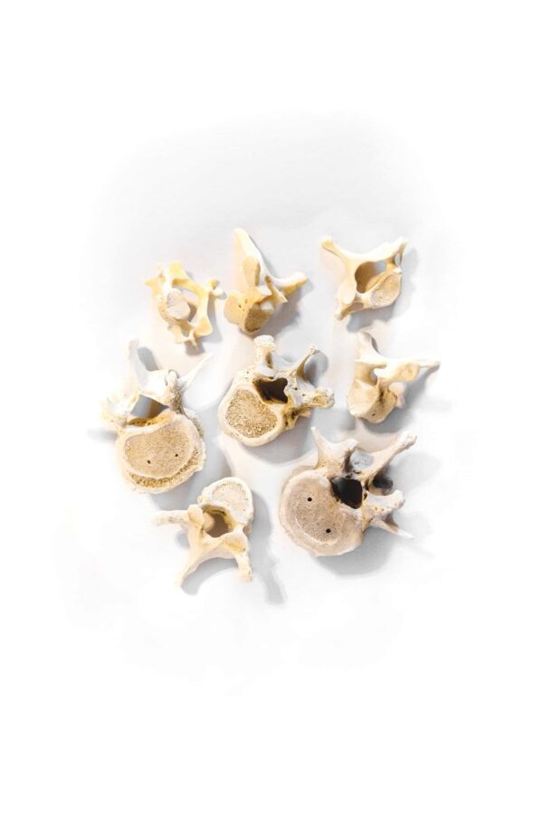 human Vertebrae