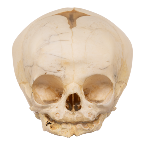 Real Research Quality Human Fetal Skull
13193